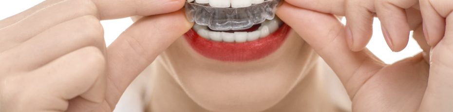 orthodontic options for all ages