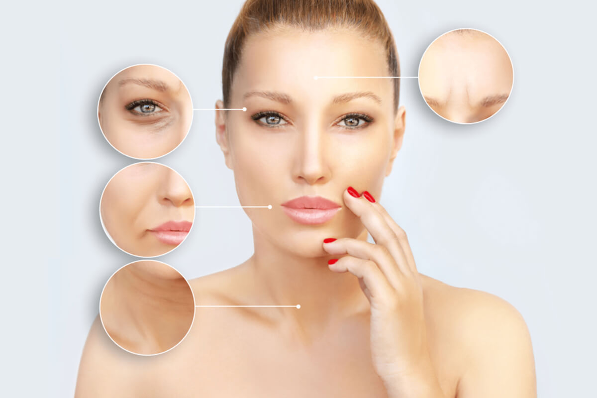everything you need to know about botox
