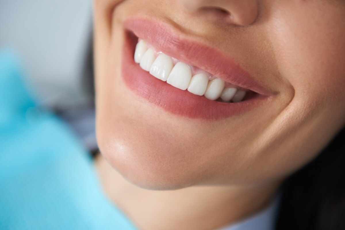 whiten your smile with these simple tricks