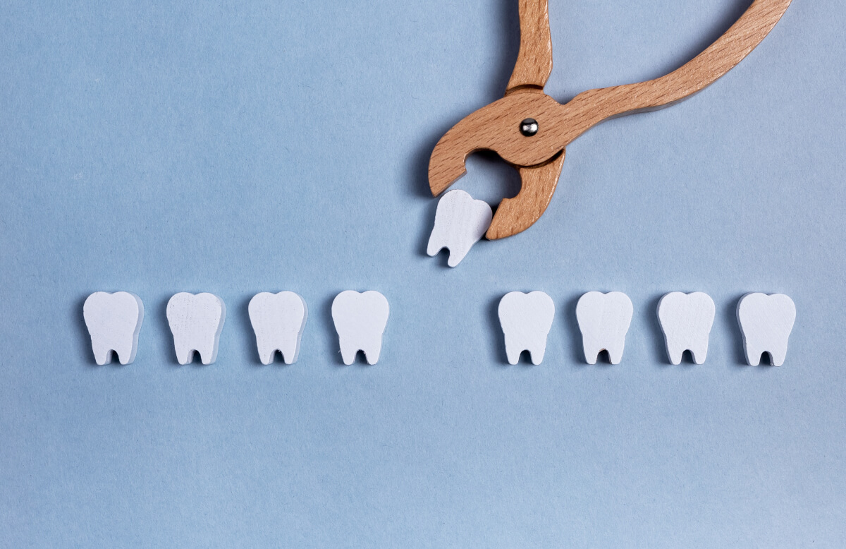 tips for a less stressful tooth extraction