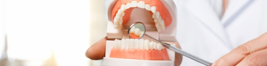 benefits of dental bridges for missing teeth in cranbrook