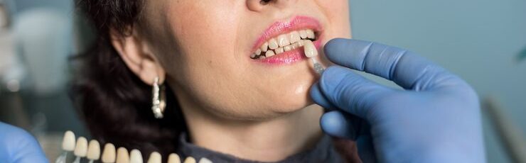 How porcelain crowns restore strength and function